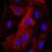OncoSarc